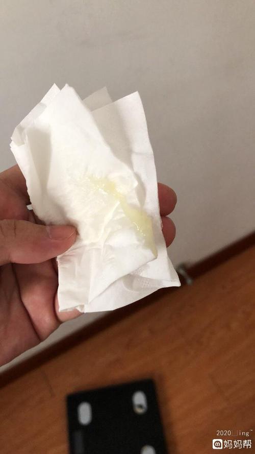 我现在37 6,最近一直有这个东西,不像白带