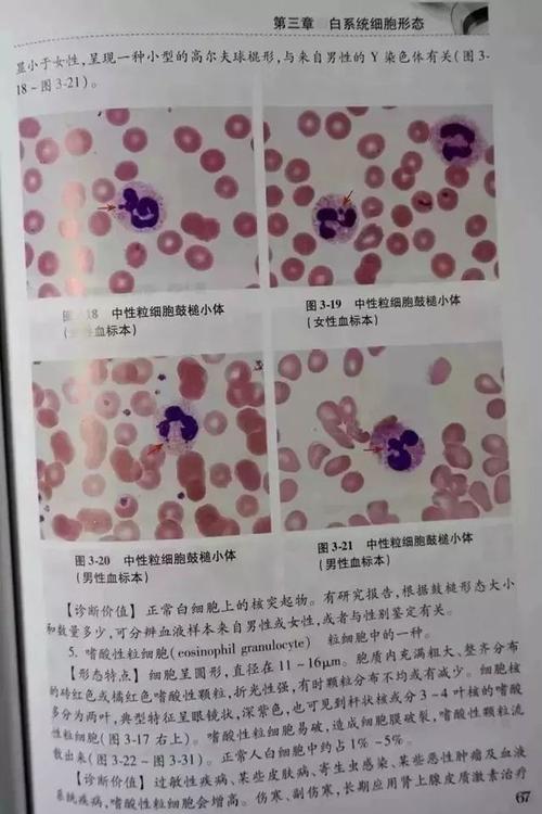 高清图谱张时民老师主编外周血细胞形态学