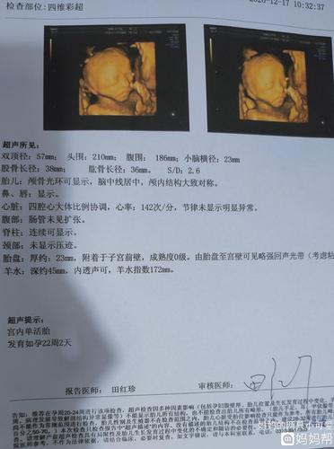 今天查了四维彩超,图1图3是我儿子的,图