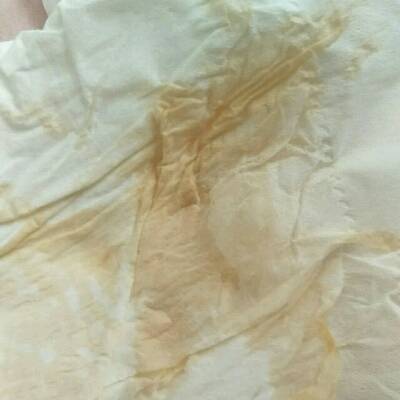 怀孕十周,睡觉期间流了黄水,然后还带点血水,怎麼回事,家里没人,没