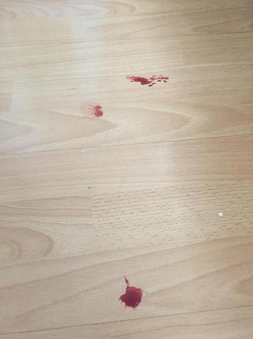 地板上的血迹