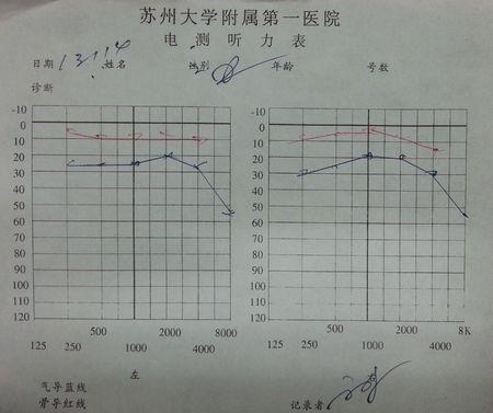 哪位专家帮我分析下我的电测听力结果,越详细越好,谢谢了.