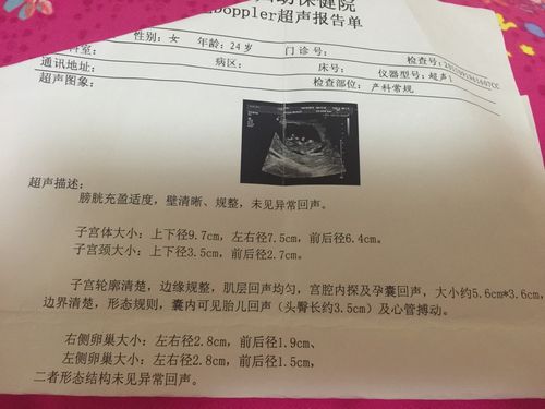 4 2楼莫宝宝:男孩  2015-11-06 09:27  安   然 ° 孕19周lv.