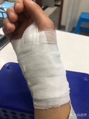 第二人民医院包扎图片 - 第3张