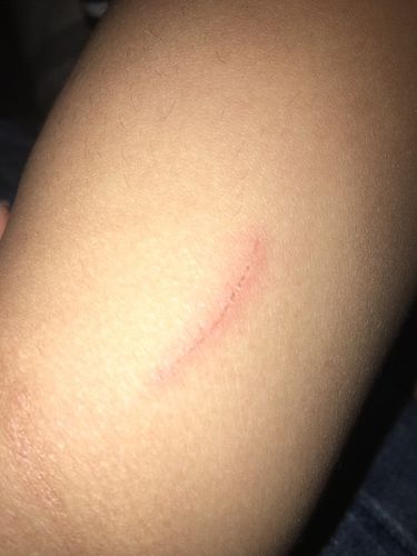 能帮忙看看这是不是狗抓的吗?急急急