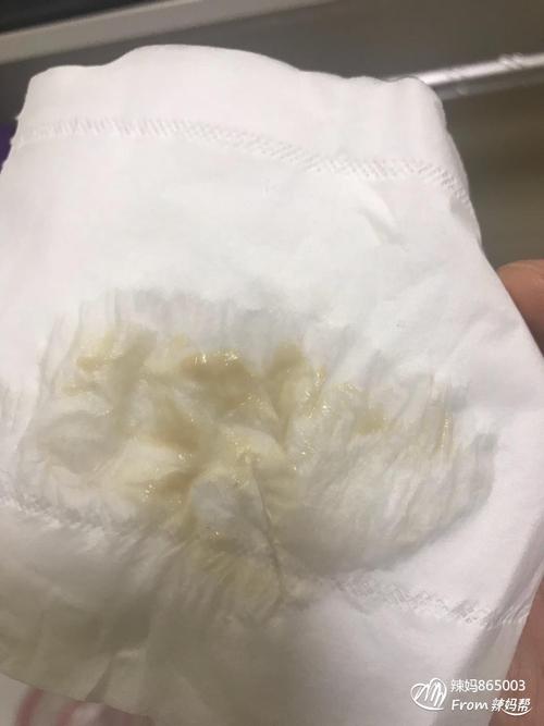 以前都是白带不是这样子的.