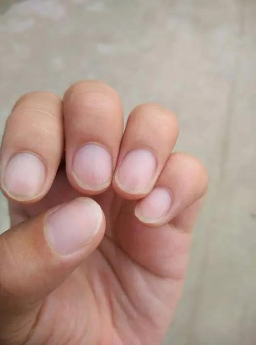 手指甲上有月牙的人与没有月牙的人谁的身体更健康