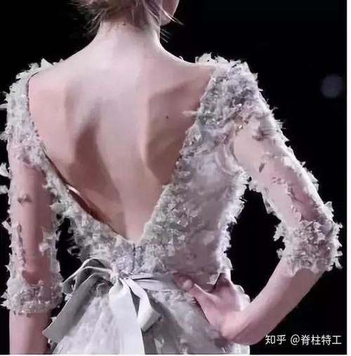 所谓"蝴蝶背",不过是翼状肩(形成原因,自测方法,矫正训练)