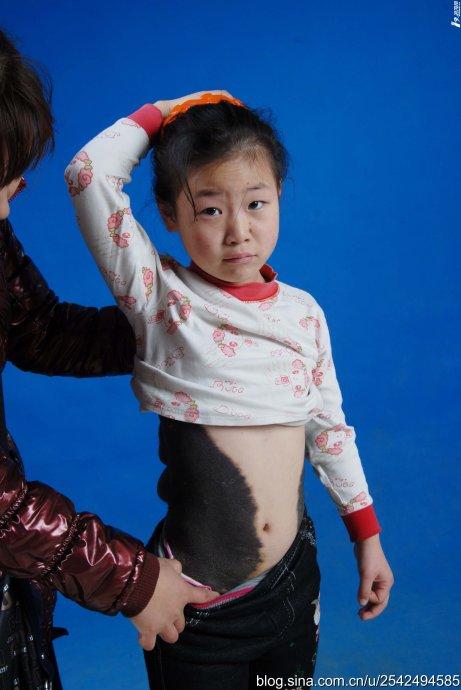 面向社会大众求助,求你们救救8岁的小女孩吧!