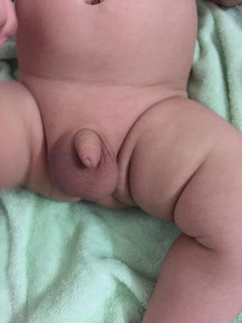 宝宝睾丸一个大一个小是什么原因?麻烦有懂的告诉我.