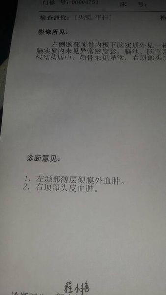 急求医,脑部ct检查结果,左颞部薄层硬膜外血肿,右顶部