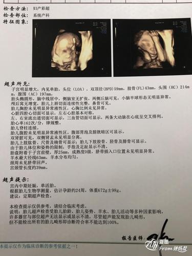 孕24周 四维b超,哪位大神懂看男女的谢谢