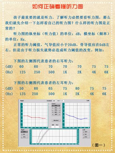 如何正确看懂听力图
