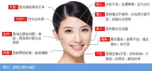 一般来说,从脸上长痘的不同位置的分布,从中医的角度分析,我们会考虑