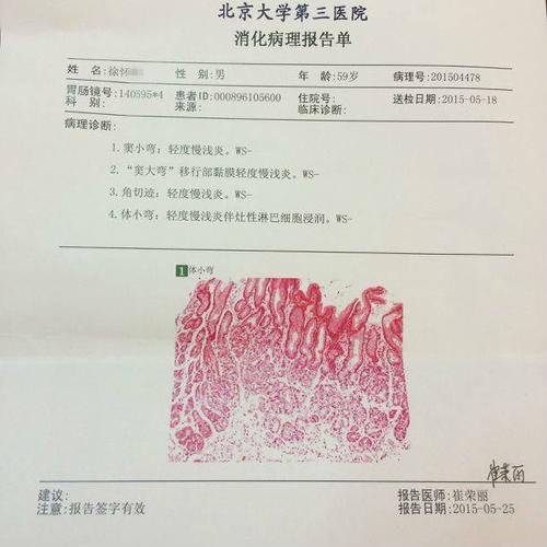 并要求在胃镜下要多取几块活检,以确定有无癌变,最后病理检查为"粘膜