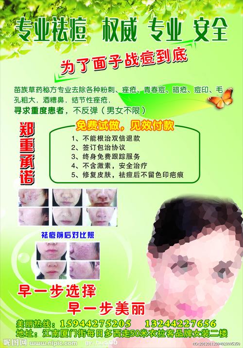 专业祛痘图片