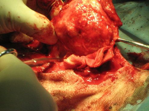 包皮上的摘除后   接下来是左侧腹股沟的