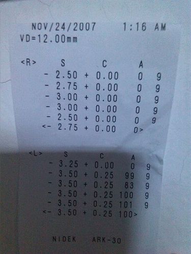 宝宝幼儿园检查视力,说宝宝有问题,请帮助看一下,宝宝