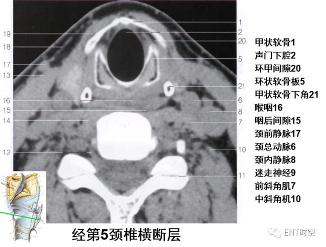 颈部和喉断层解剖