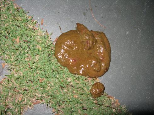 [转载]病例总结2:肠道寄生虫--钩虫