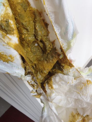 现在这个时候那也别太担心宝宝这个情况的话应该是肠胃还没有发育好的