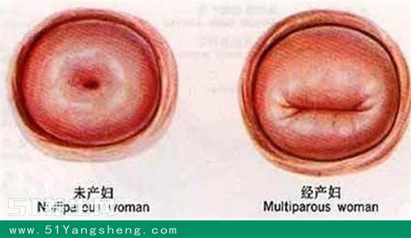 女人生没生过孩子,差别在哪里?从这3点就能看得出来