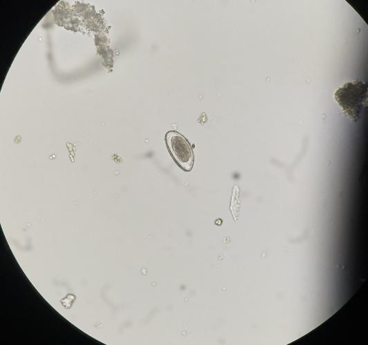 蛲虫卵:无色透明,窄长型,一侧平,另一侧稍凸,卵壳由两层壳质组成,卵壳