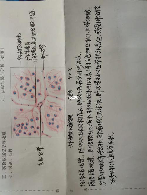 p1肾小管上皮细胞水肿