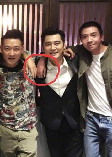 除了手部,还有脸部,据悉俞灏明整个身体烧伤面积达35%.