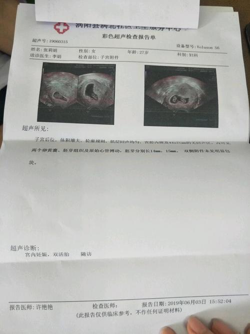 一个孕囊里面两个小孩是双胞胎,问问宝妈们也有这样的吧!