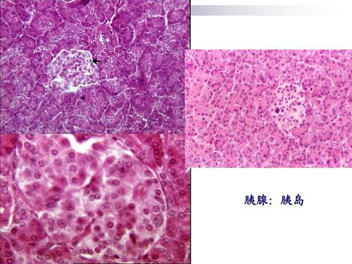 胰腺: 胰腺:胰岛