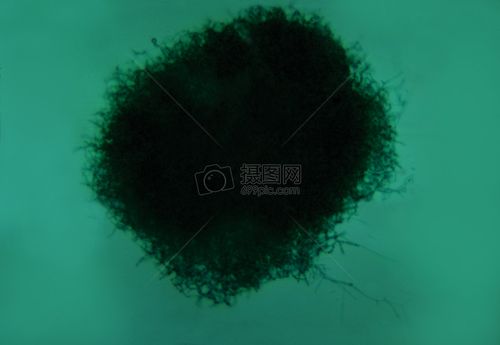 显微镜下的病菌