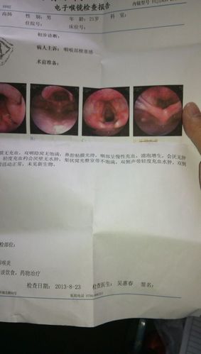 帮我看下喉镜报告单