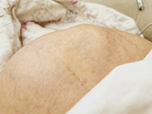 你们胎动是怎么样的呀,我这个鼓出来的应该是小脚吧