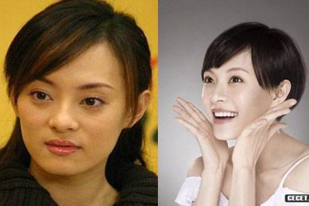 女明星 整容前后对比照 图片大全 孙俪整容