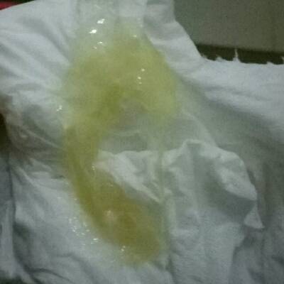 孕三十九周多,几天没有分泌物,突然出来了这样的,像鼻涕似的,什麼东西