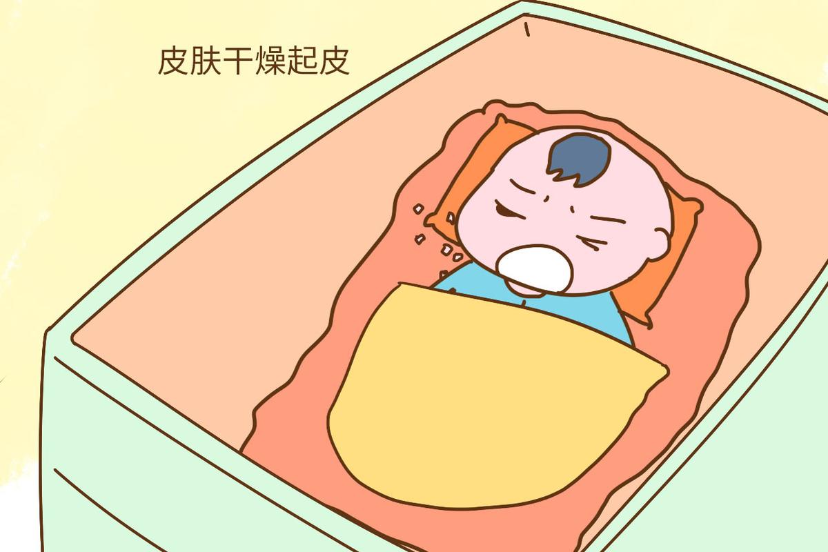 有时候我们发现宝宝的皮肤比较干燥,甚至出现了起皮的情况,这种情况