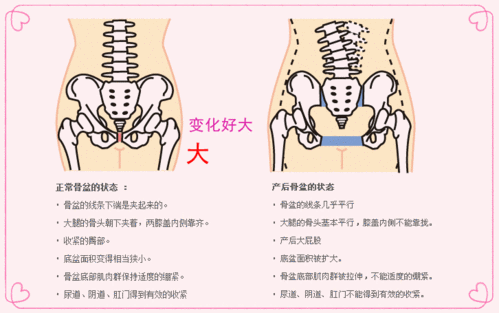 姚丁丁:盆骨恢复都不做?你的健康基本没着落