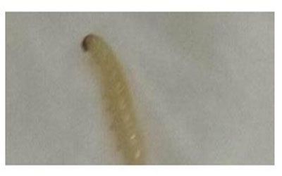 女子洗内衣竟洗出虫子,医生说出真相!女子吓出一身冷汗!