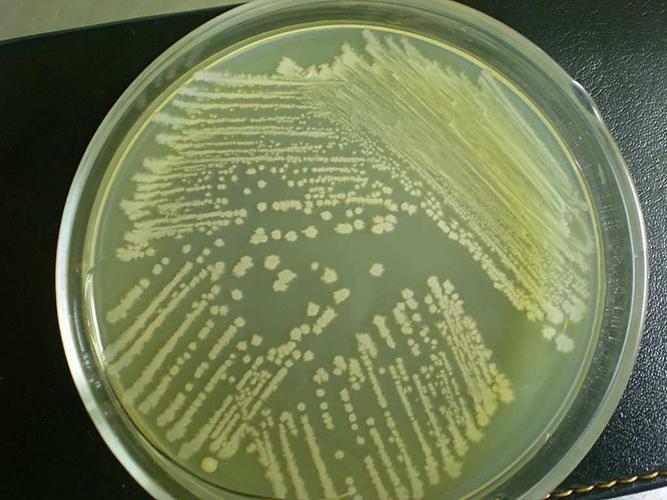 中国蓝琼脂培养基