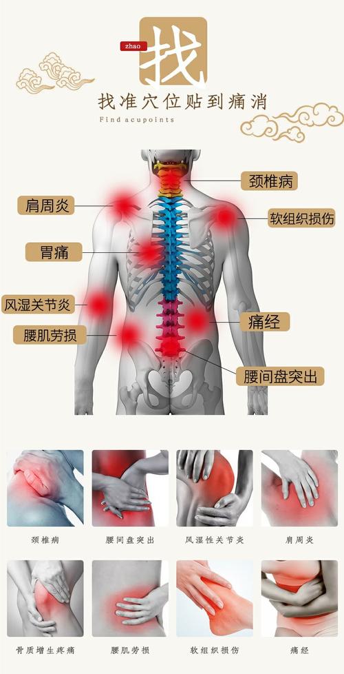 武汉国灸镇痛灸颈痛腰痛腰疼风湿贴膏腰肌劳损经络膏药贴坐骨膏贴
