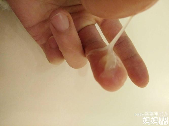 请问这个是白带拉丝吗?以前没有的现在突然有了好激动