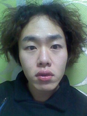 整形让我完成了屌丝到帅哥的逆袭