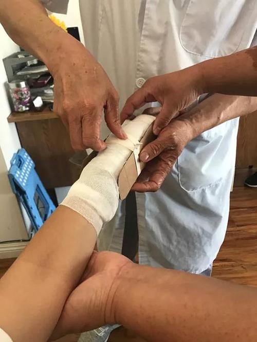 孙悦今日晒出爱妻陈露在医院进行包扎的照片,她的手臂被缠上厚厚的