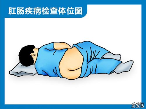 肛肠疾病检查体位图