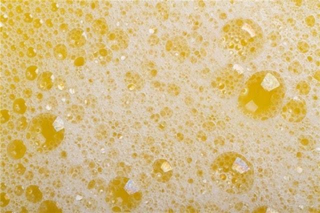 尿里有泡泡有两种情况!两招分辨是正常泡沫尿还是"噩梦"!