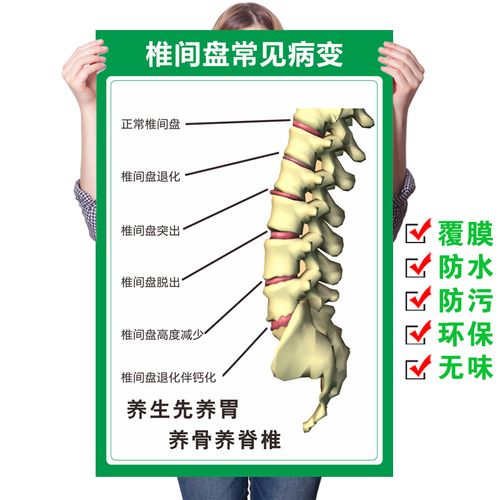 人体椎间盘常见病变颈椎 脊椎全息图 骨骼挂图医院腰椎间盘突墙贴