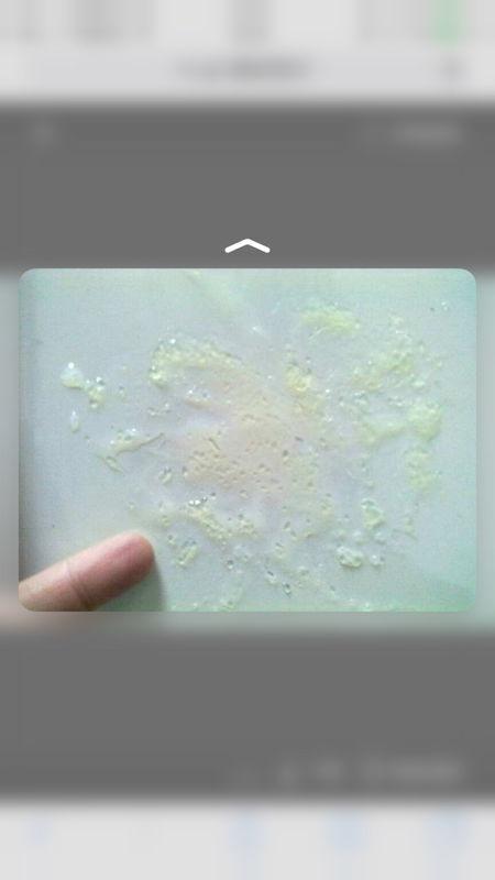 精液颜色很稀,而且伴有黄绿色,这是怎么回事