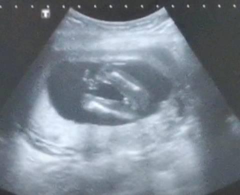 16周b超图看男孩女孩