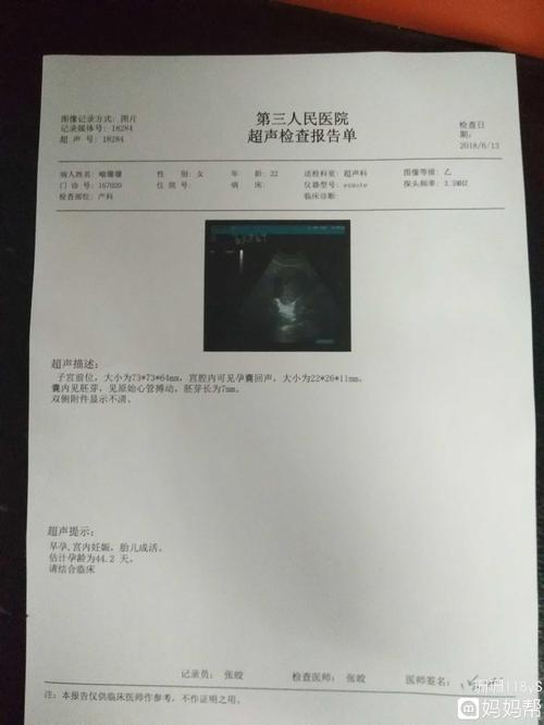 怀孕这么久就做了一个b超医生让我再过一个月去产检你们是这样的吗